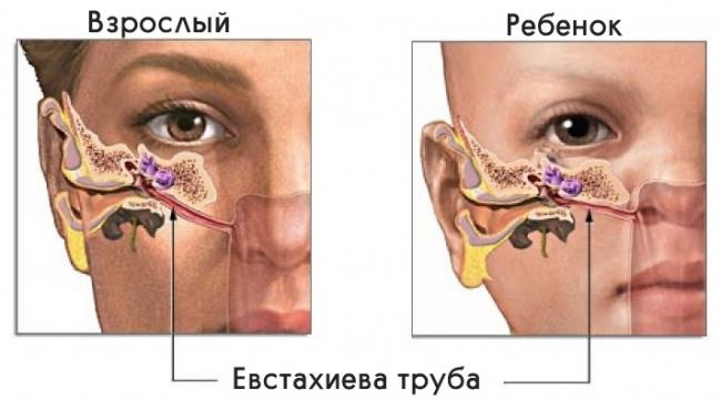 Причины и лечение заложенности уха без боли