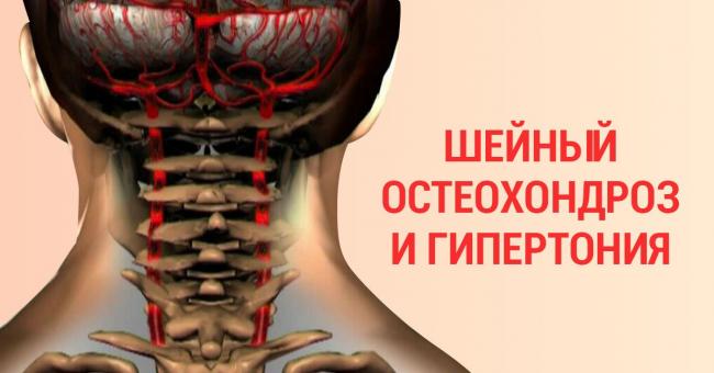 Как лечить шейный остеохондроз? остеохондроз шейного отдела позвоночника – лечение, упражнения