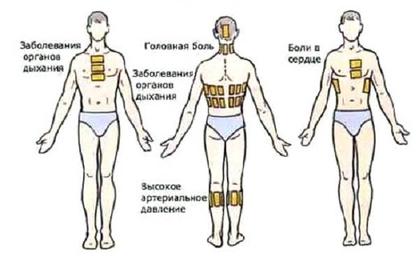 Как ставить горчичники при кашле? инструкция. детям и взрослым
