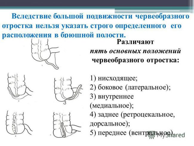 Кишка тонка