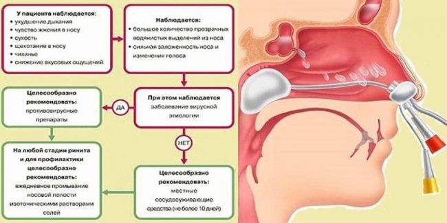 Аллергический ринит, симптомы и лечение насморка