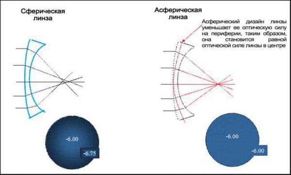 Советы оптометриста: как правильно подобрать очки и линзы