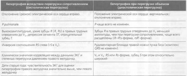 Показатели на экг, свидетельствующие о гипертрофии миокарда правого желудочка