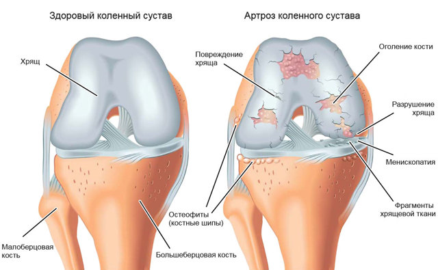 Фастум гель. инструкция по применению, цена, отзывы, аналоги