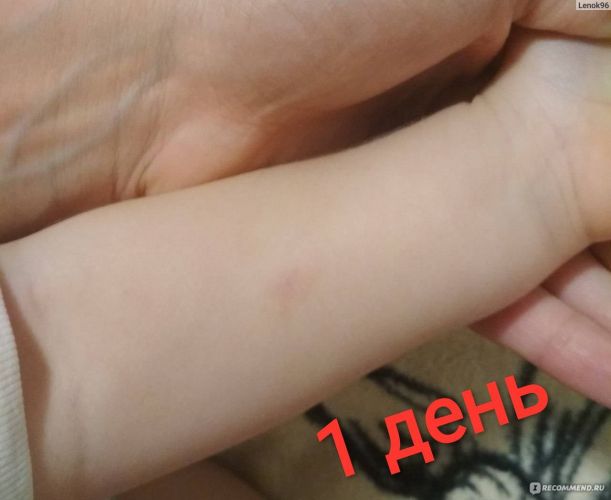 Когда нужно проверять реакцию на манту у ребенка?
