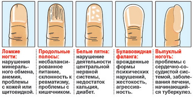 Изменился цвет ногтей на руках