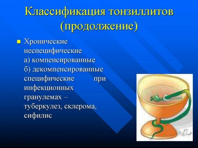Хронический компенсированный тонзиллит лечение