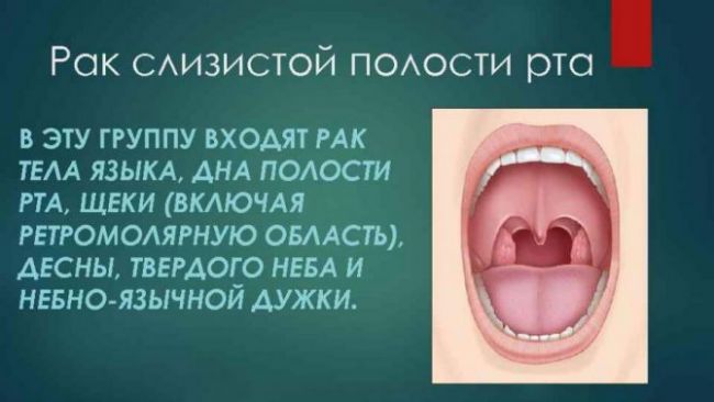 Заболевания горла и гортани, как должно выглядеть здоровое горло