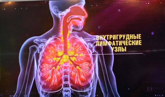 Туберкулез