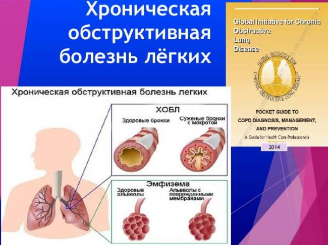 Буллезные нарушения