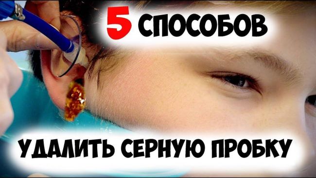 Что делать если в ухе пробка?