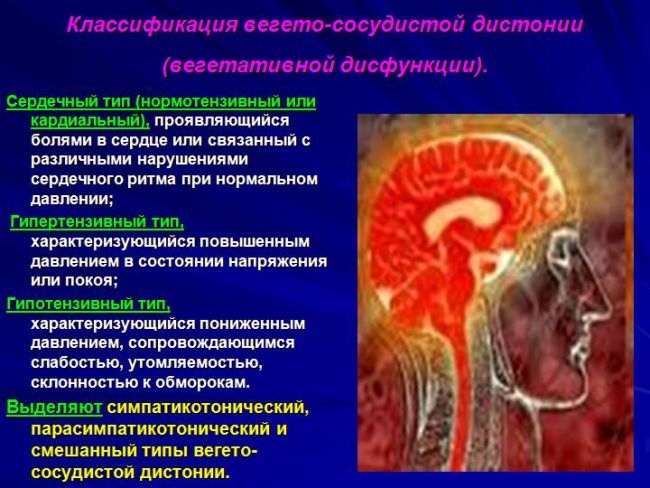 Диета при всд меню на неделю