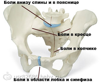 Симфизит - как рожать?