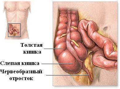 Признаки и диагностика хронического аппендицита