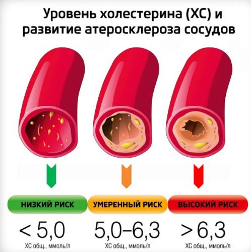 6 продуктов, снижающих холестерин. диета при высоком холестерине. как снизить холестерин в домашних условиях? советы врача-кардиолога