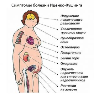 Что такое синдром иценко кушига