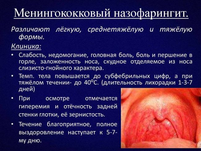 Симптомы и лечение менингококковой инфекции у детей
