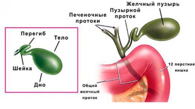 Перегиб шейки желчного пузыря.