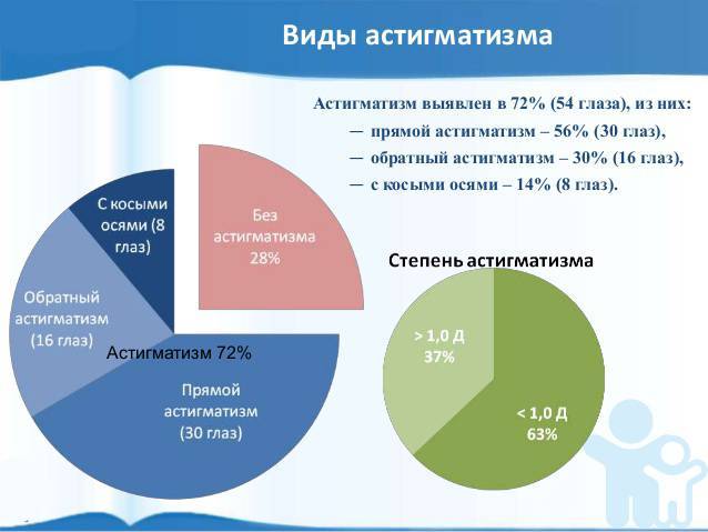 Астигматизм: как правильно подобрать очки?