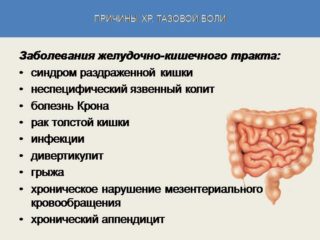 Мышечный спазм