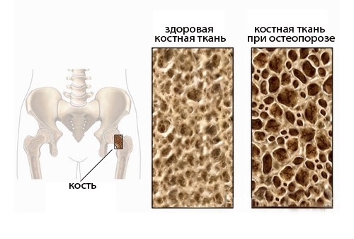 Бивалос: инструкция по применению
