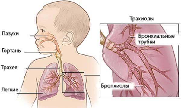 Бронхит у ребенка: симптомы без температуры и лечение