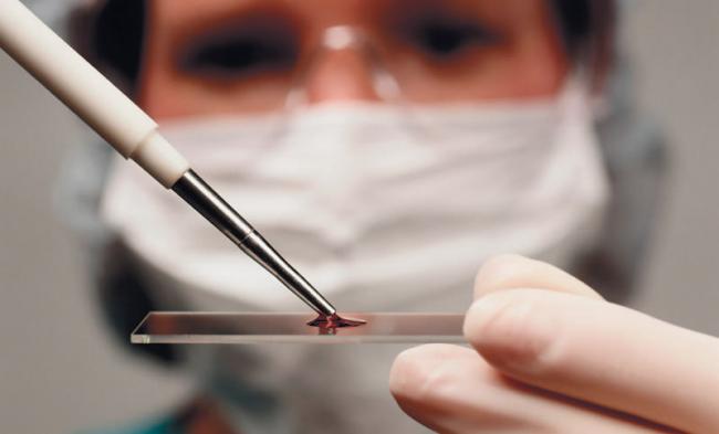 Признаки лейкоза по анализу крови у взрослых