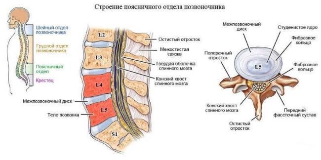 Как лечить протрузию дисков l4-l5 и l5-s1