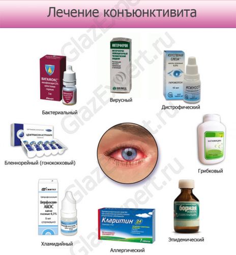 Капли для глаз аломид — подробная инструкция. эффективное средство от аллергии глаз