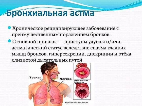 Климат для астматиков