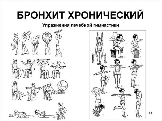 Лфк и дыхательная гимнастика при пневмонии: упражнения, которые помогут восстановиться