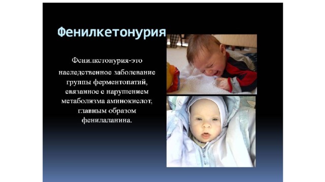 Фенилкетонурия (фку). причины, симптомы, диагностика и лечение фенилкетонурии. лечение фенилкетонурии: диета и питание.