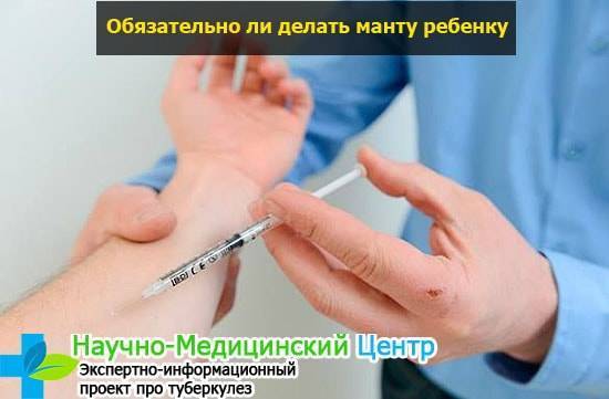 Какая должна быть реакция манту: норма у детей и взрослых