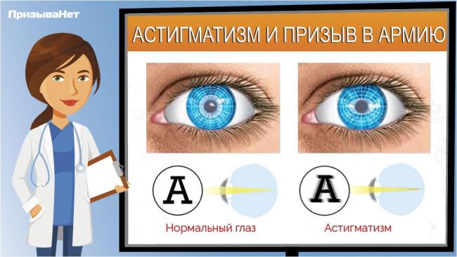Отличия дальнозоркости, близорукости и астигматизма