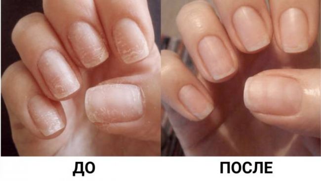 Хотите иметь красивые и здоровые ногти?