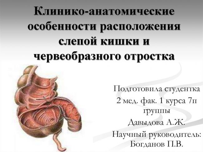 Тема: заболевания червеобразного отростка