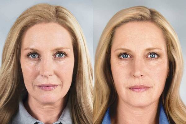 Крем Химани Боро Плюс Healthy Skin - отзывы