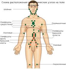 Метастазы в брюшной полости