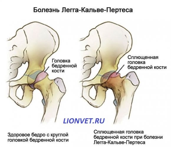 Остеохондропатии костей