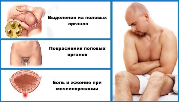 Хламидиоз (хламидийная инфекция) - симптомы болезни, профилактика и лечение хламидиоза (хламидийной инфекции), причины заболевания и его диагностика на eurolab