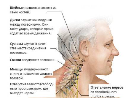 Вертеброгенная цервикокраниалгия: что это, образование болезни на фоне шейного остеохондроза, лечение, симптомы