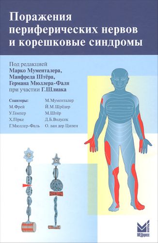 Что такое полинейропатия? симптомы и лечение поражений нервно-мышечного аппарата