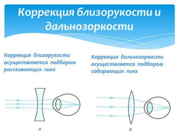 Пролонгированный режим ношения линз это мягкие линзы длительного какие выбрать уход контактные