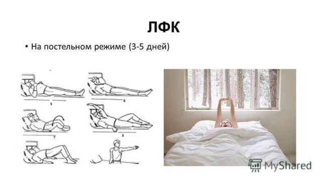 Методика восстановления легких дыхательной гимнастикой после пневмонии