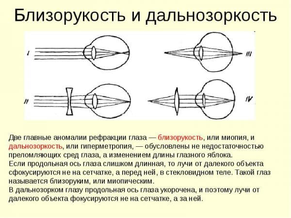 Первый раз надевать цветные линзы, как это делать: как правильно - проверка дефектов, техника, хранение, со скольки носить, для чувствительных глаз