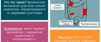 Характеристика препарата артелар и его применение