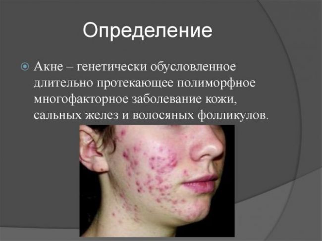 Прыщ в ухе: причины образования, что делать и как лечить | советы медика