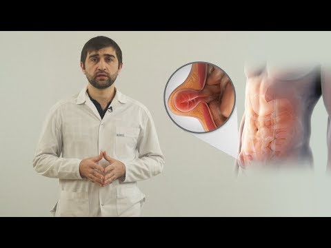 Принципы питания после удаления паховой грыжи