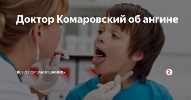 Ангина у ребенка.