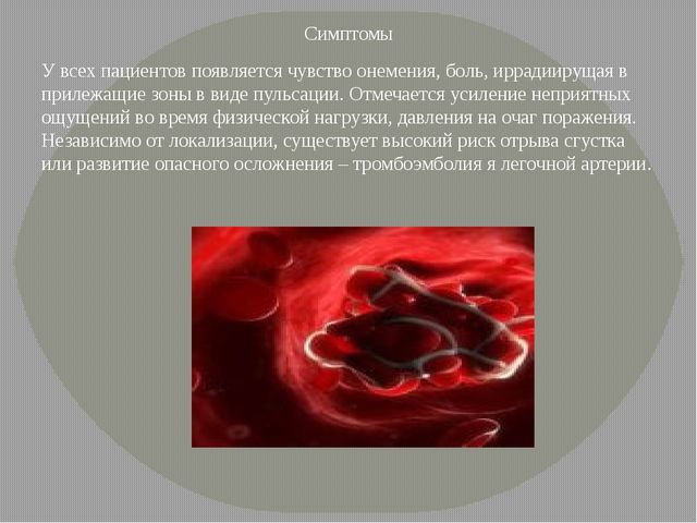 Тромбоз: причины, симптомы, лечение, профилактика